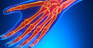 Hand-pain relief in Fircrest, Tacoma, and University Place, Washington.