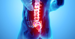 Improper lifting, poor posture, lack of regular exercise, fracture, ruptured disk or arthritis can cause lower back pain - Fircrest, Tacoma, University Place, Washington.